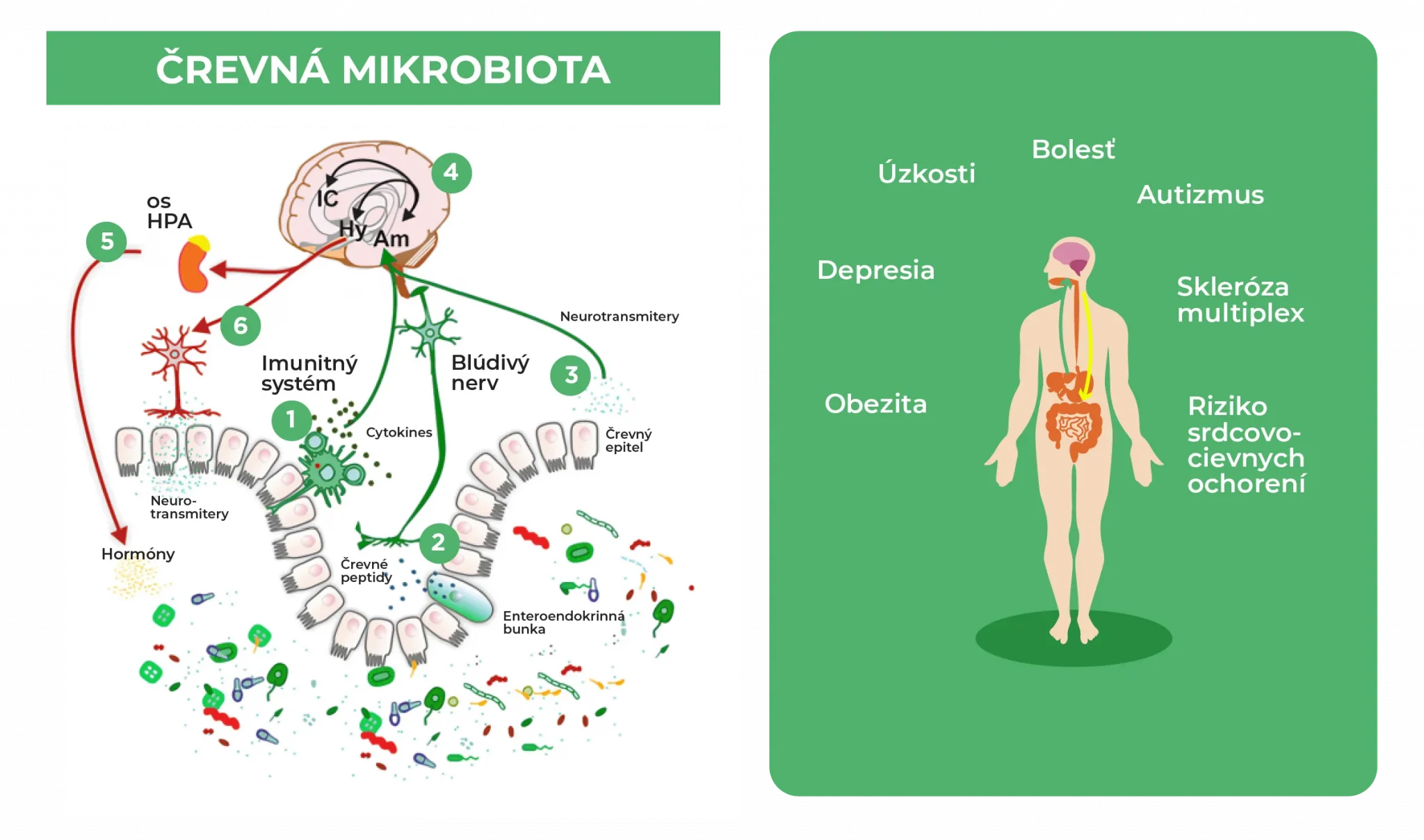mikrobiota-črevá-mozog
