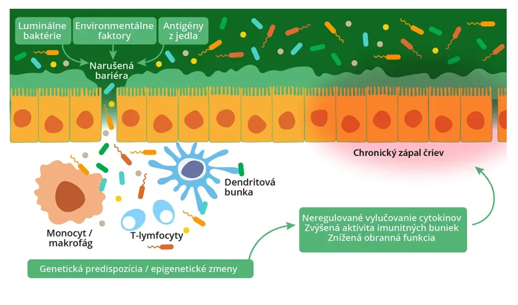 zápalové ochorenia čriev