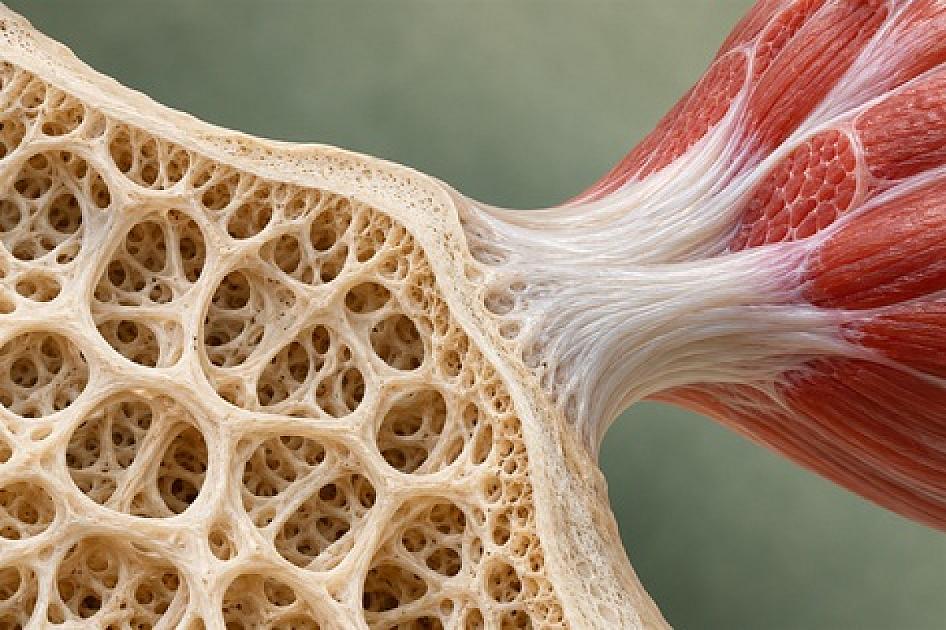 Osteosarkopénia po 60: ako chrániť kosti a svaly pred pádmi a zlomeninami